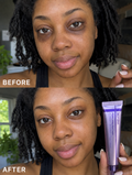 Precise Eye Lifting Fixer