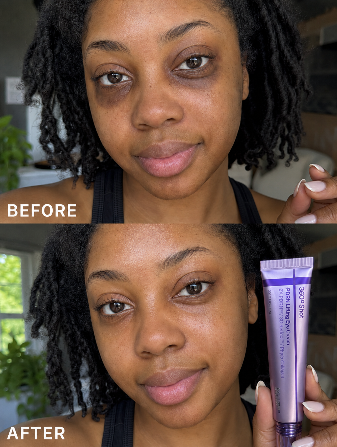 Precise Eye Lifting Fixer