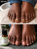 Pure Tea Tree Essential Oil