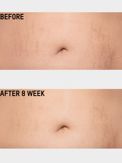 Smooth & Tighten Belly Cream