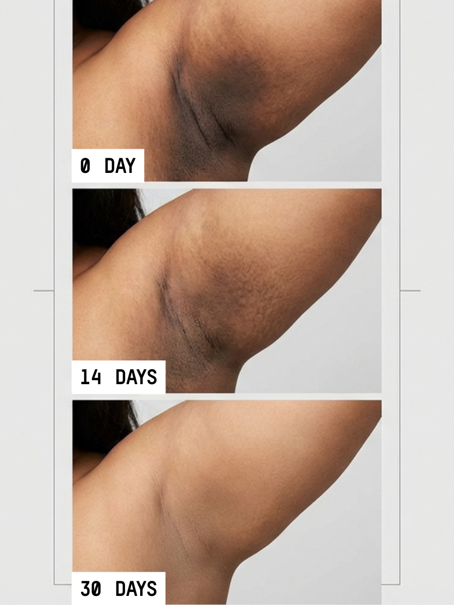 Uneven Skin Tone Eraser