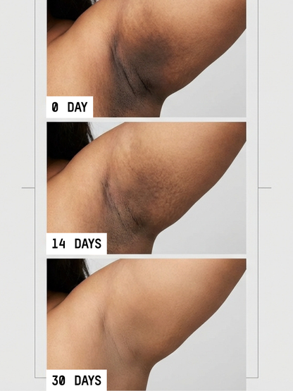 Uneven Skin Tone Eraser