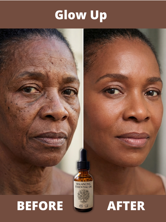 Balancing Essential Oil-(SKIN)