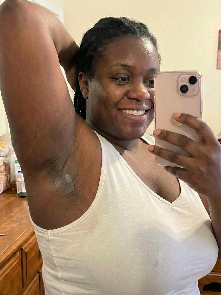 Micro-needle Deodorant Patches