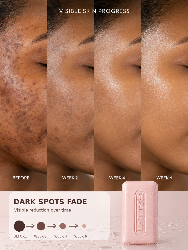 Kojic Acid Glow Bar