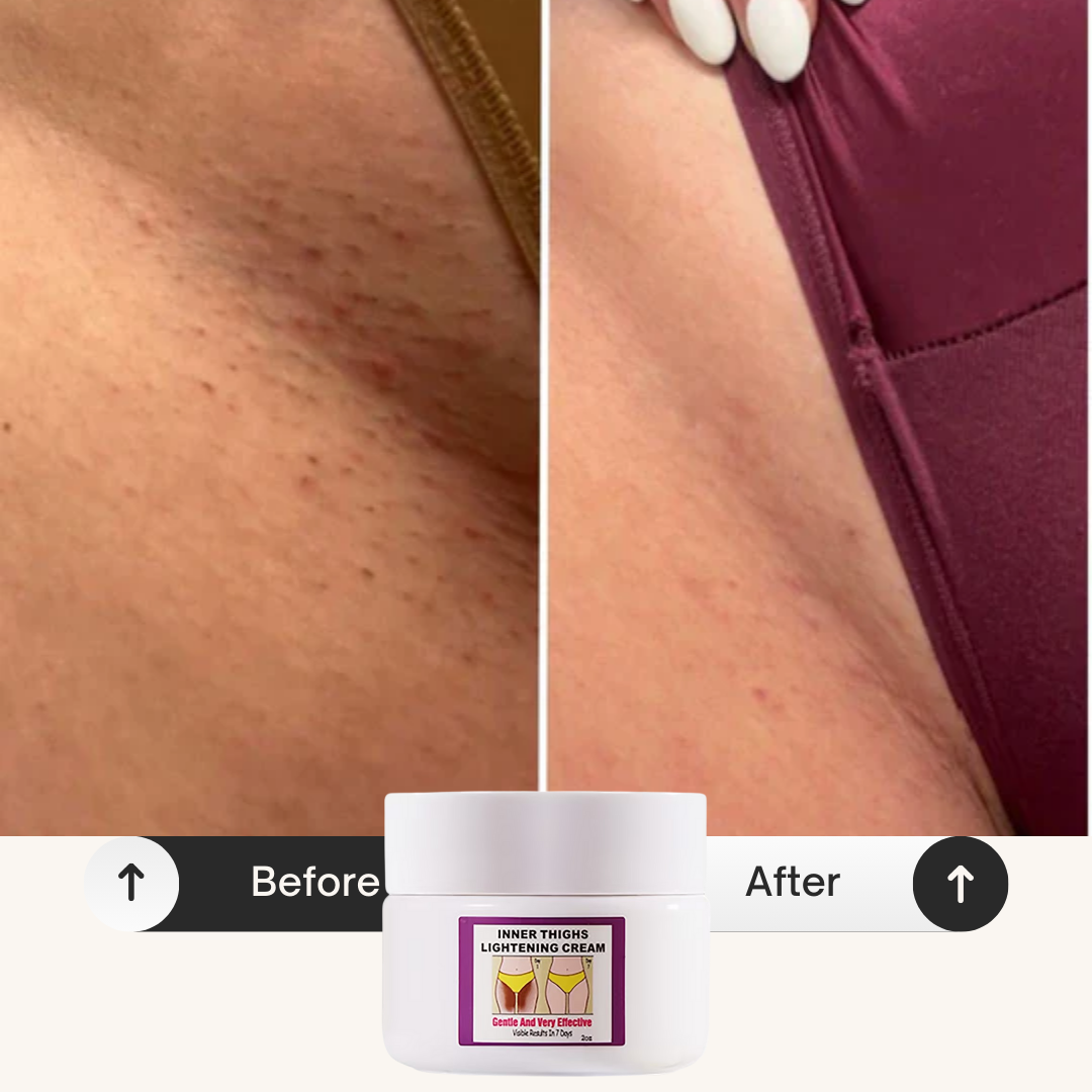 Inner Thighs Lightening Cream