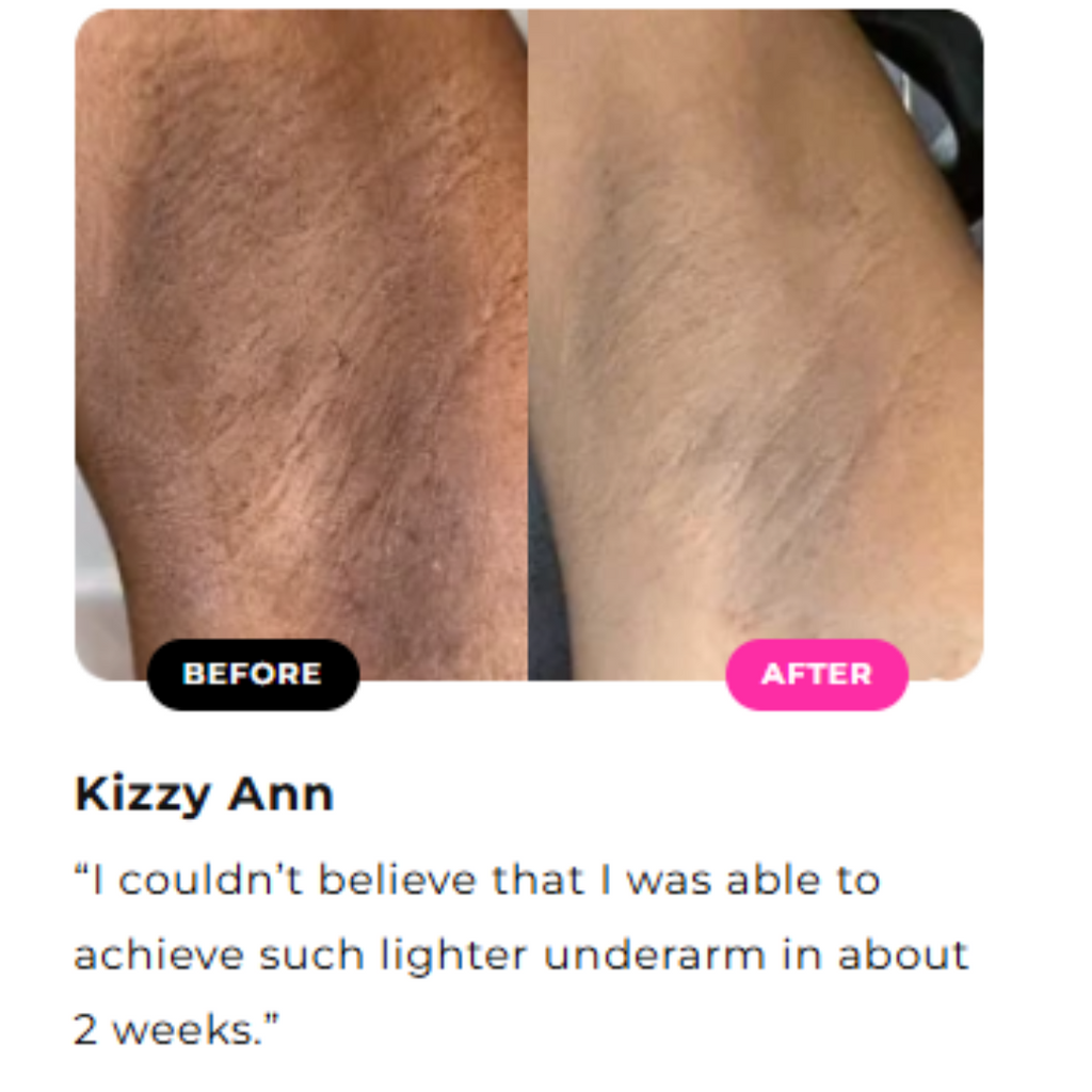 Inner Thighs Lightening Cream