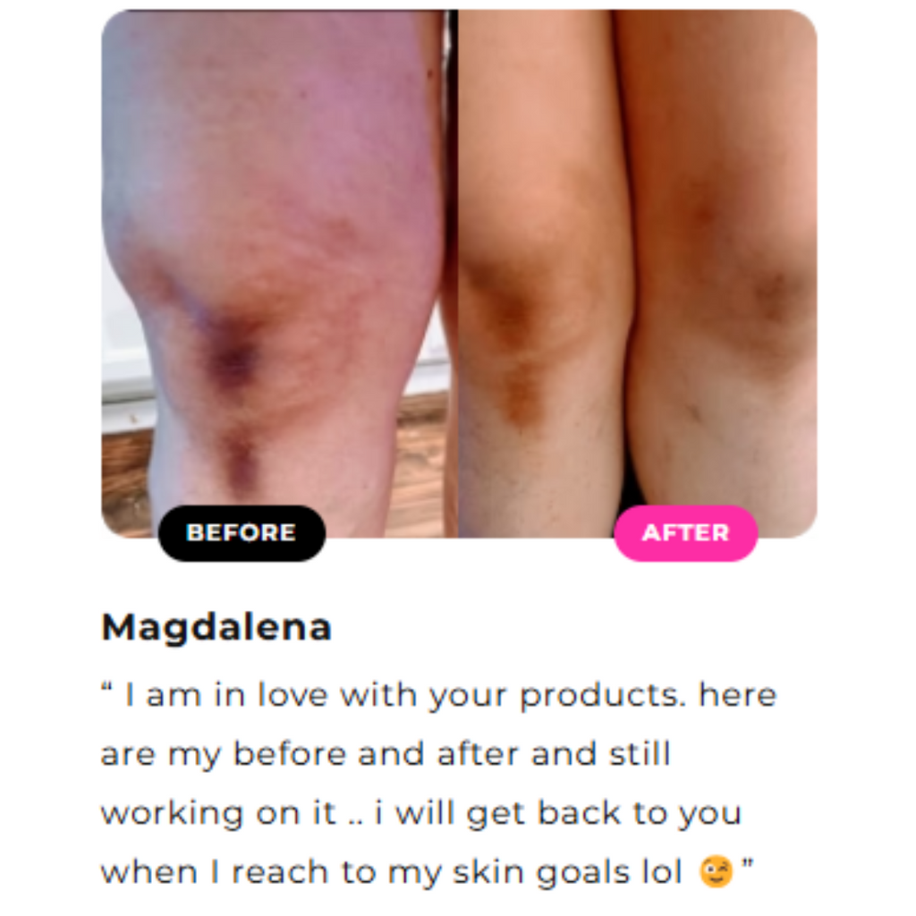 Inner Thighs Lightening Cream