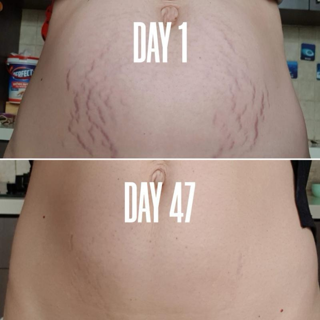 B-FLAT Belly Firming Cream