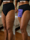 Invisible Skin Tightening Tape