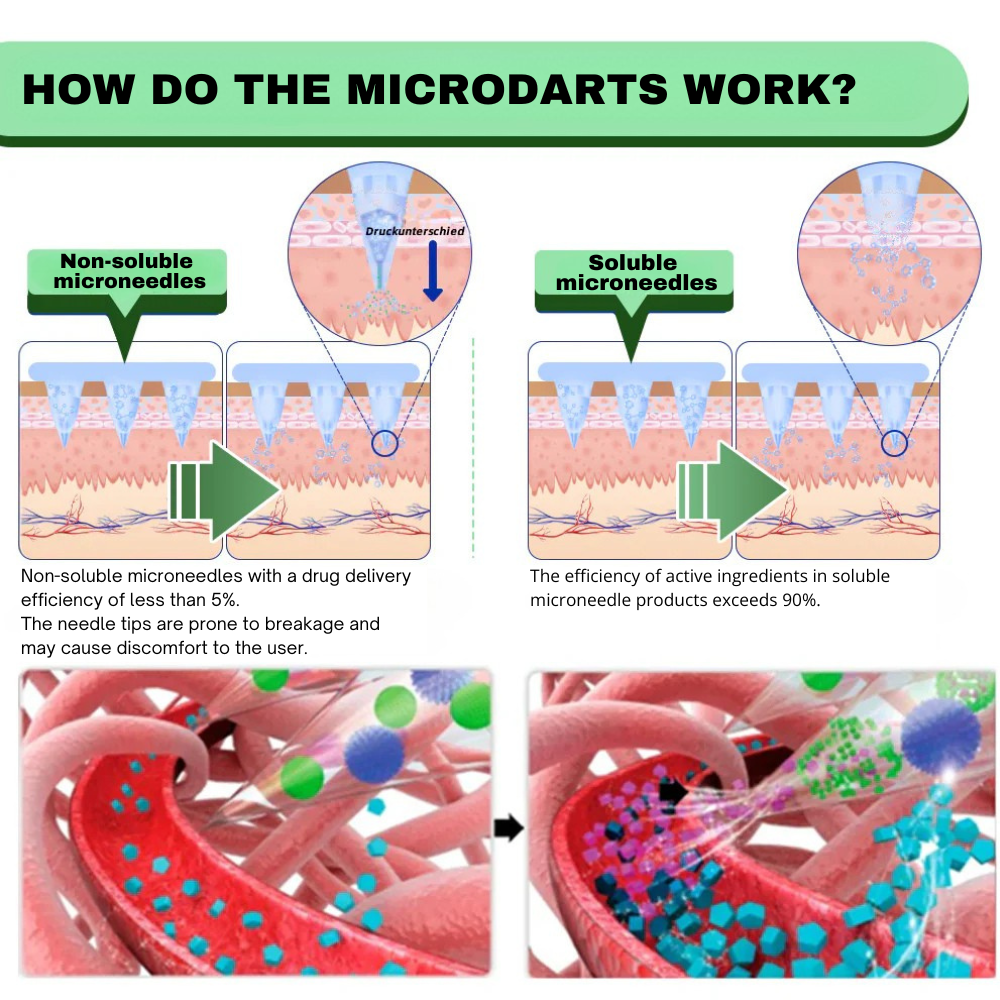 SMGT-GLP-1 Nano-Microneedle Patch