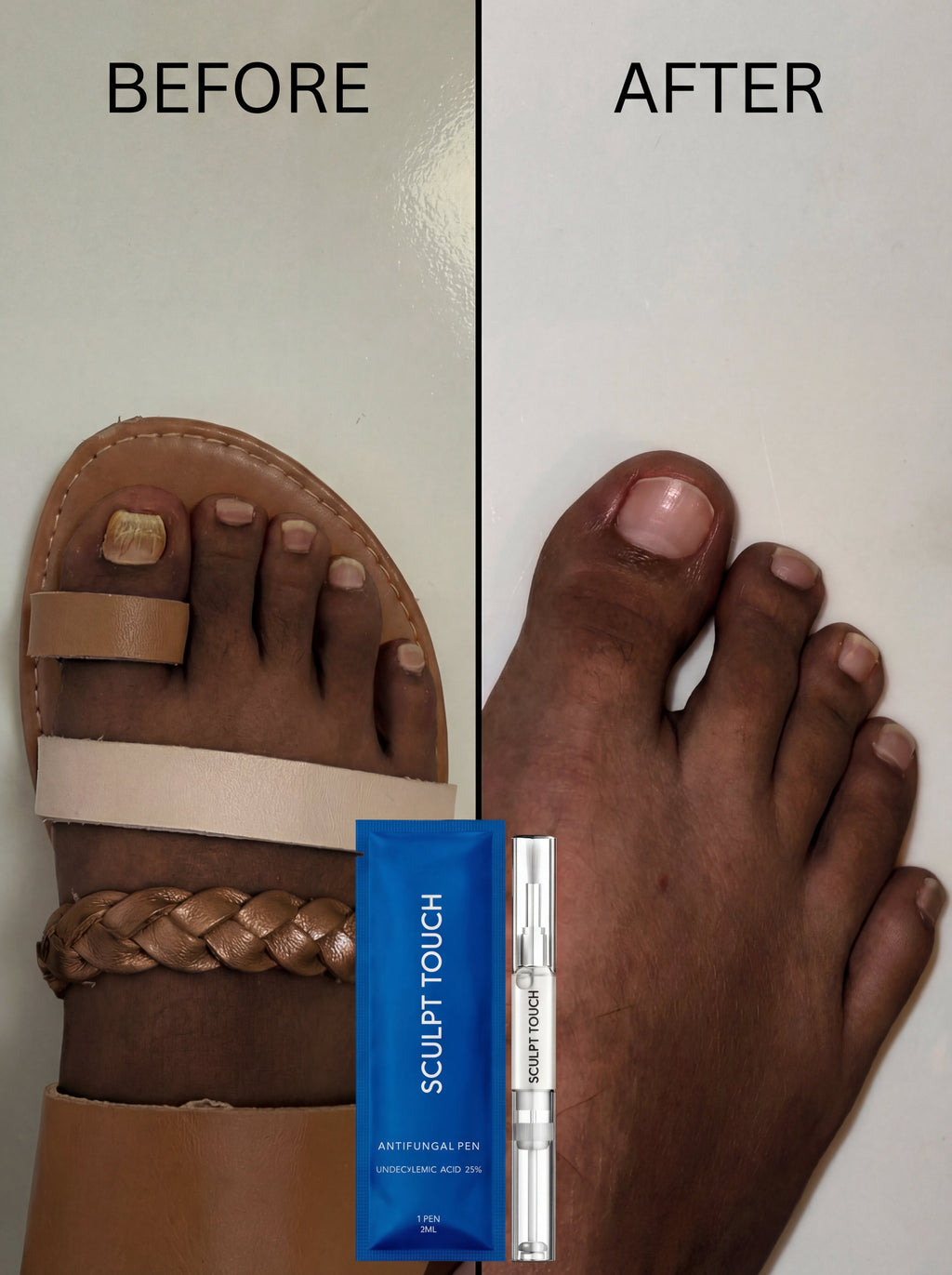 Lunavia Fungus Cure