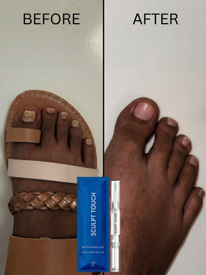 Lunavia Fungus Cure