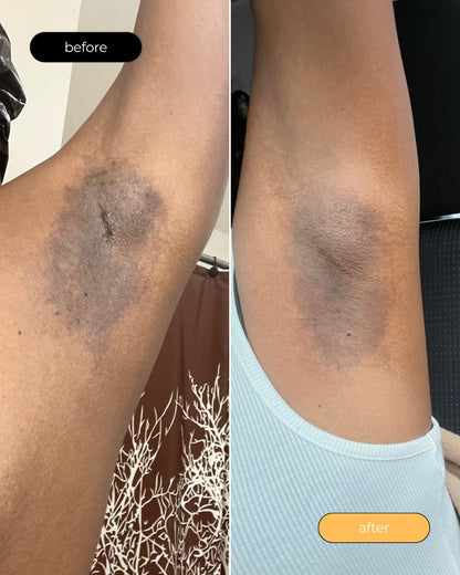 Turmeric Dark Spot Assasin Scrub