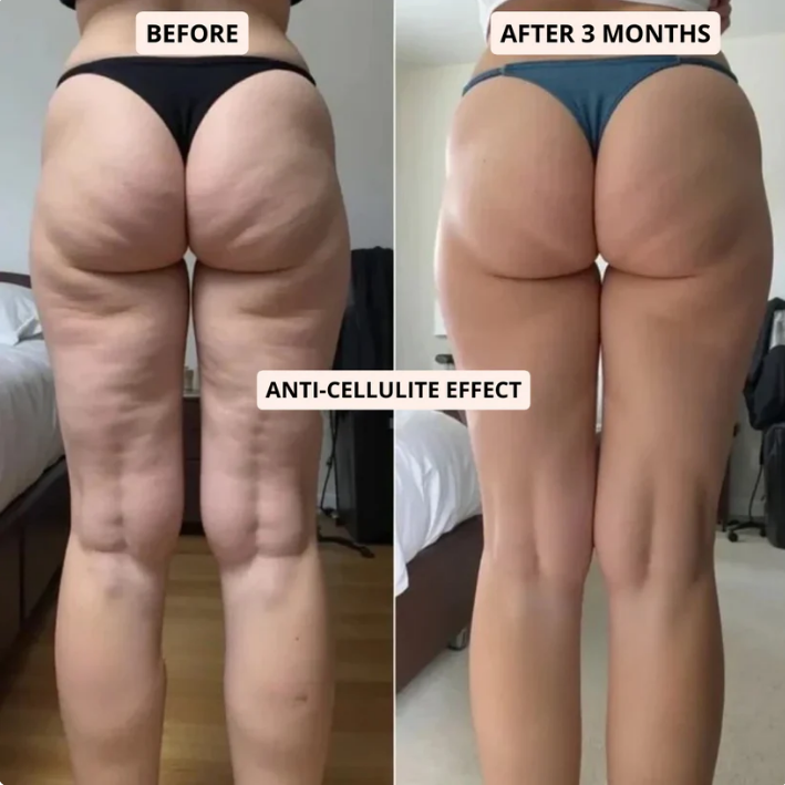 3D Fat-Burning Leggings