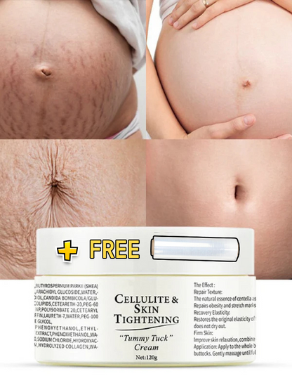 Cellulite&Skin Tightening
