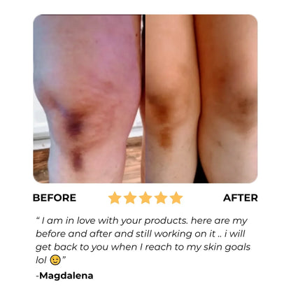 Turmeric Dark Spot Assasin Scrub